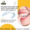 Invisible Braces in AS Rao Nagar, Hyderabad.