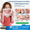 Braces Treatment in AS Rao Nagar near me