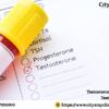 Understanding the Right Testosterone Normal Value Range