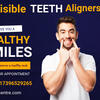 Is Invisalign Teeth Aligners Good for your Teeth? | Smile Dental and Implant Centre