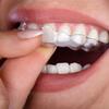 Invisalign Treatment in Pune by Dr. Preeti Kulkarni – Clear Aligners for Perfect Smile