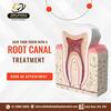 Best Dentists for Root Canal Treatment near Sainikpuri