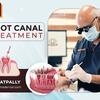 Best Root Canal Treatment in Kukatpally – FMS Dental
