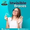 How Invisible Braces Fix Crooked Teeth in As Rao Nagar